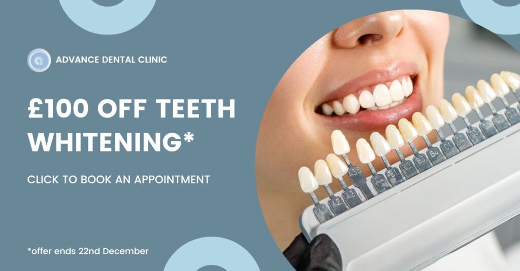 Teeth whitening Banner - Advance Dental Clinic
